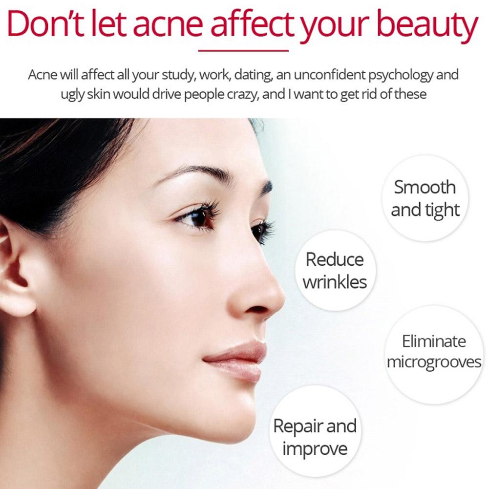 ريتينول كريم رفع ثبات إزالة ال - مراجعة Retinol Anti Wrinkle Cream وسعره
